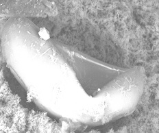 Ротовая присоска: Б – полулунная складка глотки на дне ротовой присоски